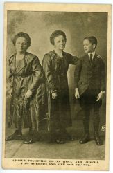 Siamská dvojčata Blažkovy - sada dokumentů, 1912